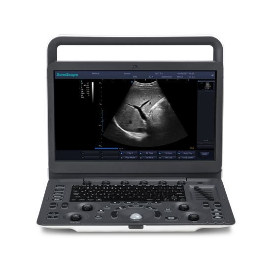 Sonoscape E1 Ultrasound | OPC Health